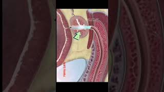 Download lagu The process of removing male tadpoles! #men'shealth #fertilitytips #viral mp3 Download lagu The process of removing male tadpoles! #men'shealth #fertilitytips #viral mp3