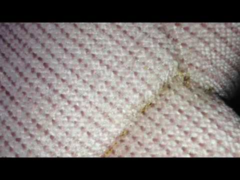 Tiny Bed Bugs Play Hide and Seek in Fords, NJ