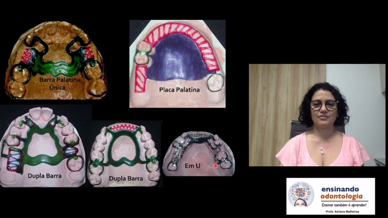 CONECTOR MAIOR - PPR