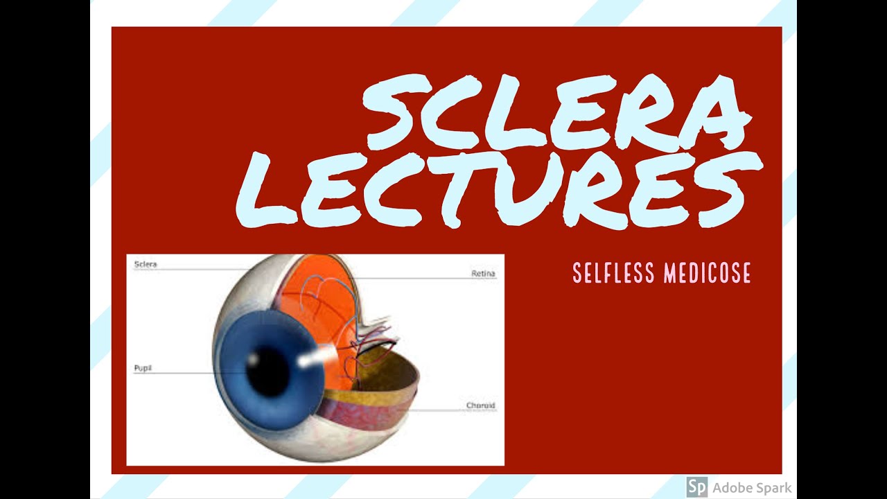 SCLERA ANATOMY, basic concept to undrstand pathology - YouTube