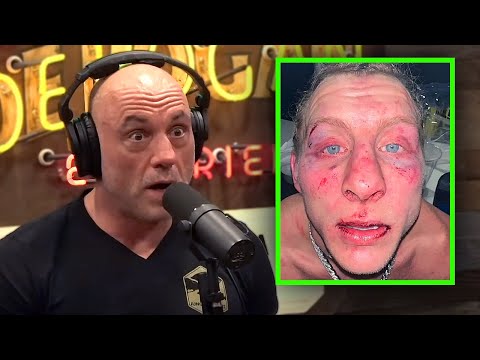 "THIS IS SERIOUS!" Joe Rogan REACTS to Paddy Pimblett BRUTAL Injury after Justin Gaethje Fight! UFC
