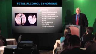 Fetal Alcohol Syndrome