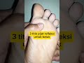 3 Titik Pijat Refleksi Untuk Batuk Pijatrefleksi Pijatbatuk Telapakkaki