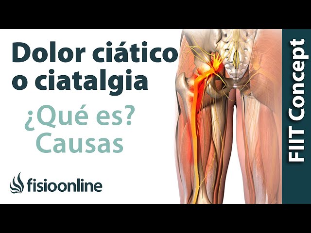 ¿Qué es la ciática o ciatalgia y cuáles son sus causas?