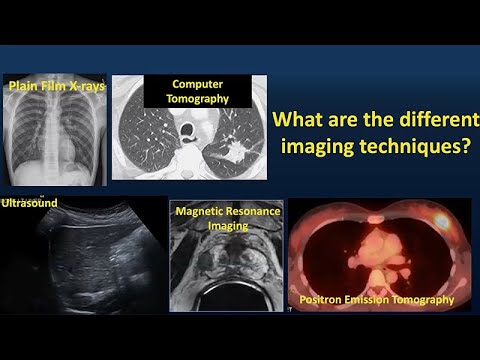 How is Cancer Diagnosed?