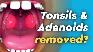 Tonsils and Adenoids Surgery