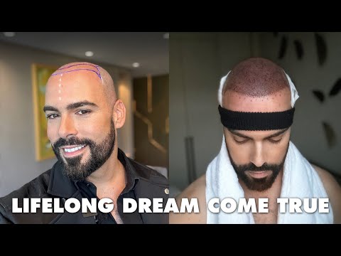 My Emotional Hair Transplant Journey in Istanbul,...