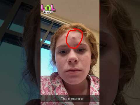 Harper’s Monster Zit!