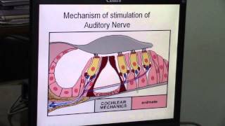 [Hearing] - Mechanism of stimulation of Auditory Nerve .Dr.Hany Gamal