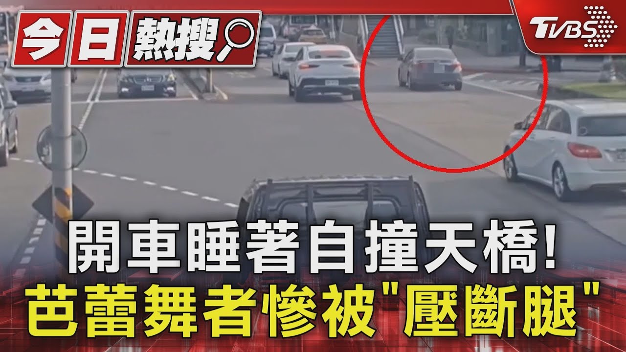 開車睡著自撞天橋!芭蕾舞者慘被「壓斷腿」