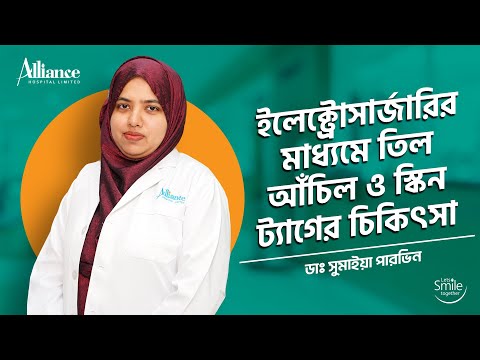 ইলেক্ট্রোসার্জারির মাধ্যমে তিল, আঁচিল স্কিন ট্যাগের চিকিৎসা | ডাঃ সুমাইয়া পারভিন