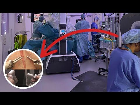 What I've learnt after over 200 Robotic Surgeries in Gynaecology