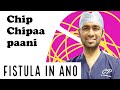 Chip Chipaa Paani After FISTULA SURGERY I Recovery I Dressing