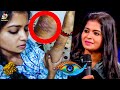 Madhumitha S Real Wounds Revealed Bigg Boss 3 Daniel Annie