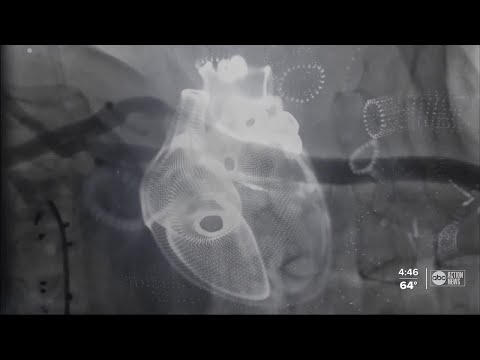 Doctors warn of Broken Heart Syndrome and its triggers