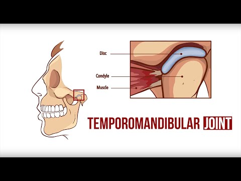 What is Bruxism? | Capital Smiles | Schenectady Capital District TMD/TMJ Dentist