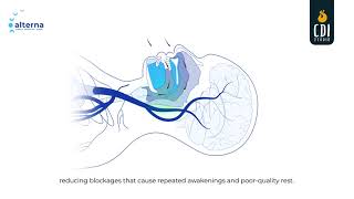 Treating Sleep Apnea with OAT