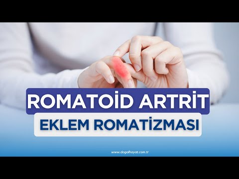 ROMATOİD ARTRİT EKLEM ROMATİZMASI