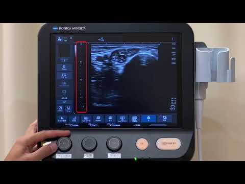 エコーメーターについて詳しく解説