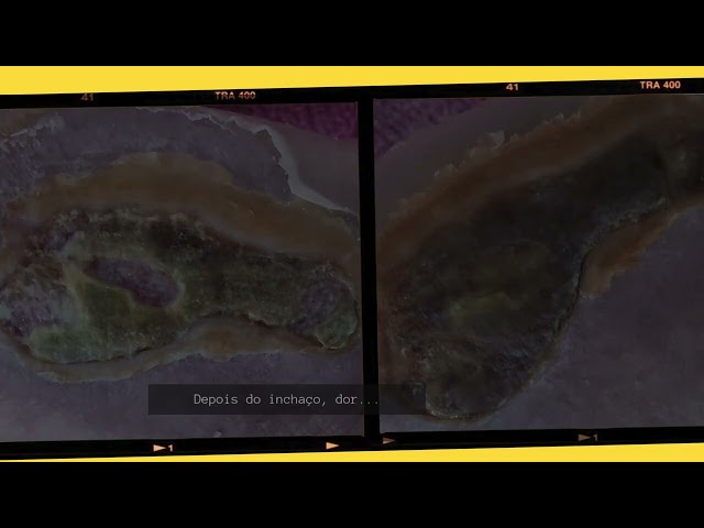 C.Y.S. 2025
cristina syono
foto-arte-psicoterapia
acidente