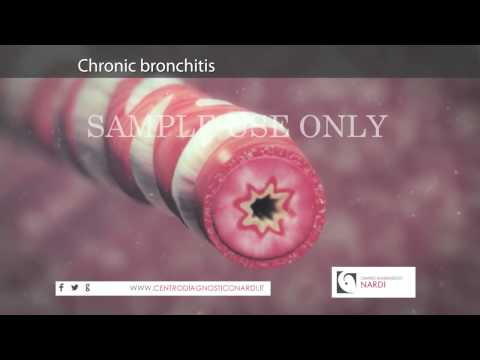Crick girare ciò che fa male Dolori articolari dopo la rimozione della ghiandola tiroidea