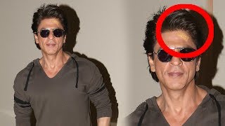 Shah Rukh Khan Has Hurt His Forehead During Promotions Of Jab Harry Met Sejal