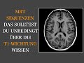 MRT Sequenzen I T1w I Gehirn I Neuroradiologie I Brain & Synapse