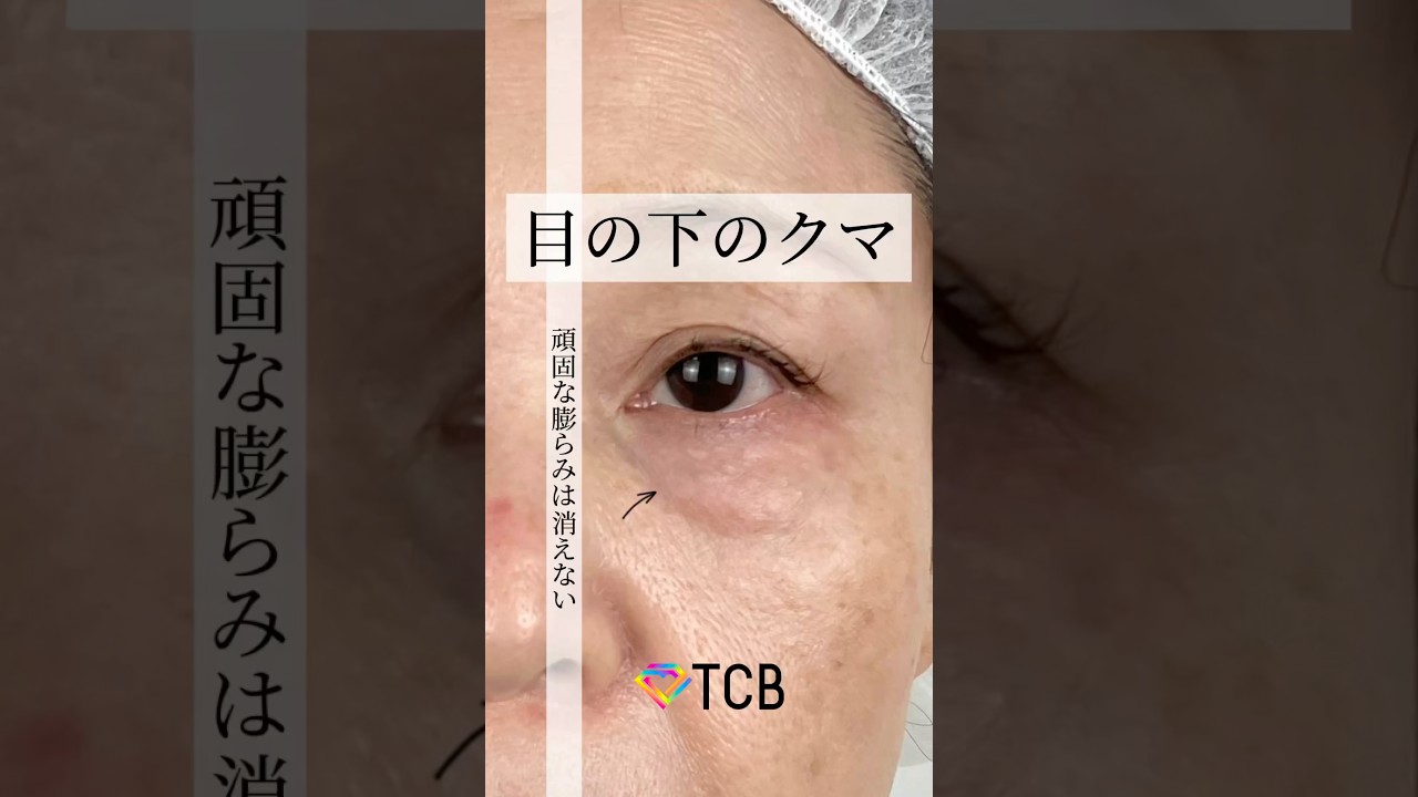 Youtubeのサムネイル