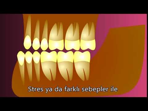 Ćwiczenia mięśni ud zewnętrzna Kulturystyka Wiadomości z różnych dziedzin