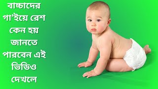 baby rash removing cream।baby rash cream।cutpricebd