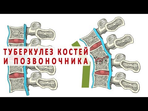 Болит грудина после падения на спину Физкультура боль в тазобедренных суставах