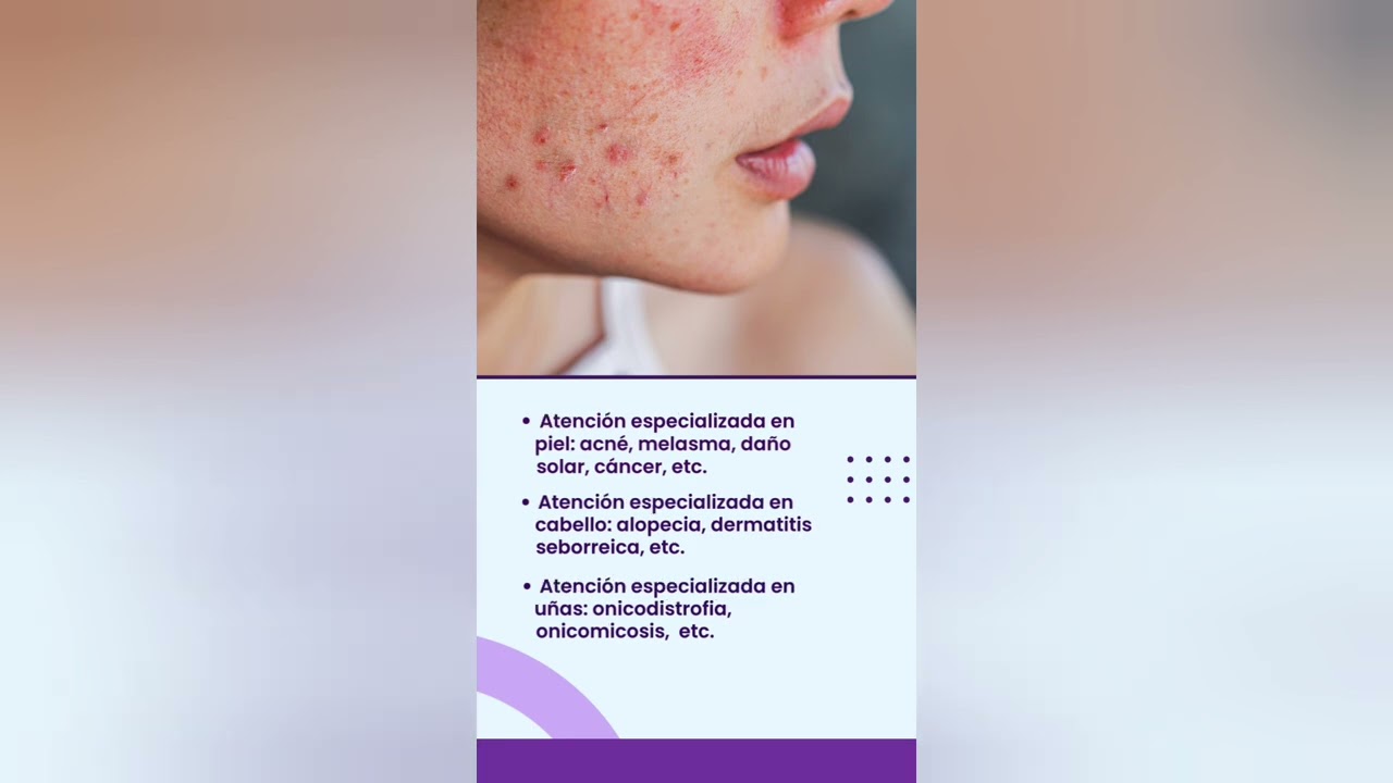 Edmundo Denis Rodriguez-17