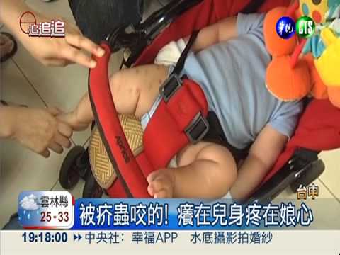 月子中心有蟲?! 嬰兒被咬染疥瘡
