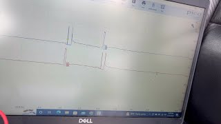 OBD Code p2156 Guide to Repair