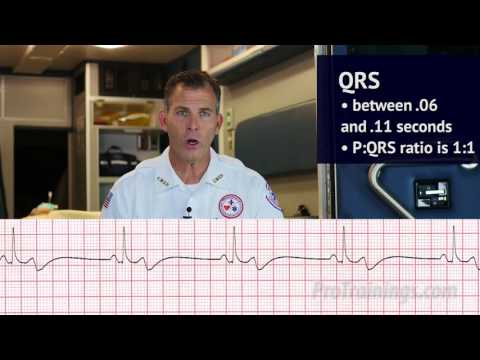 Bradycardia (ECG Rhythm Interpretation)