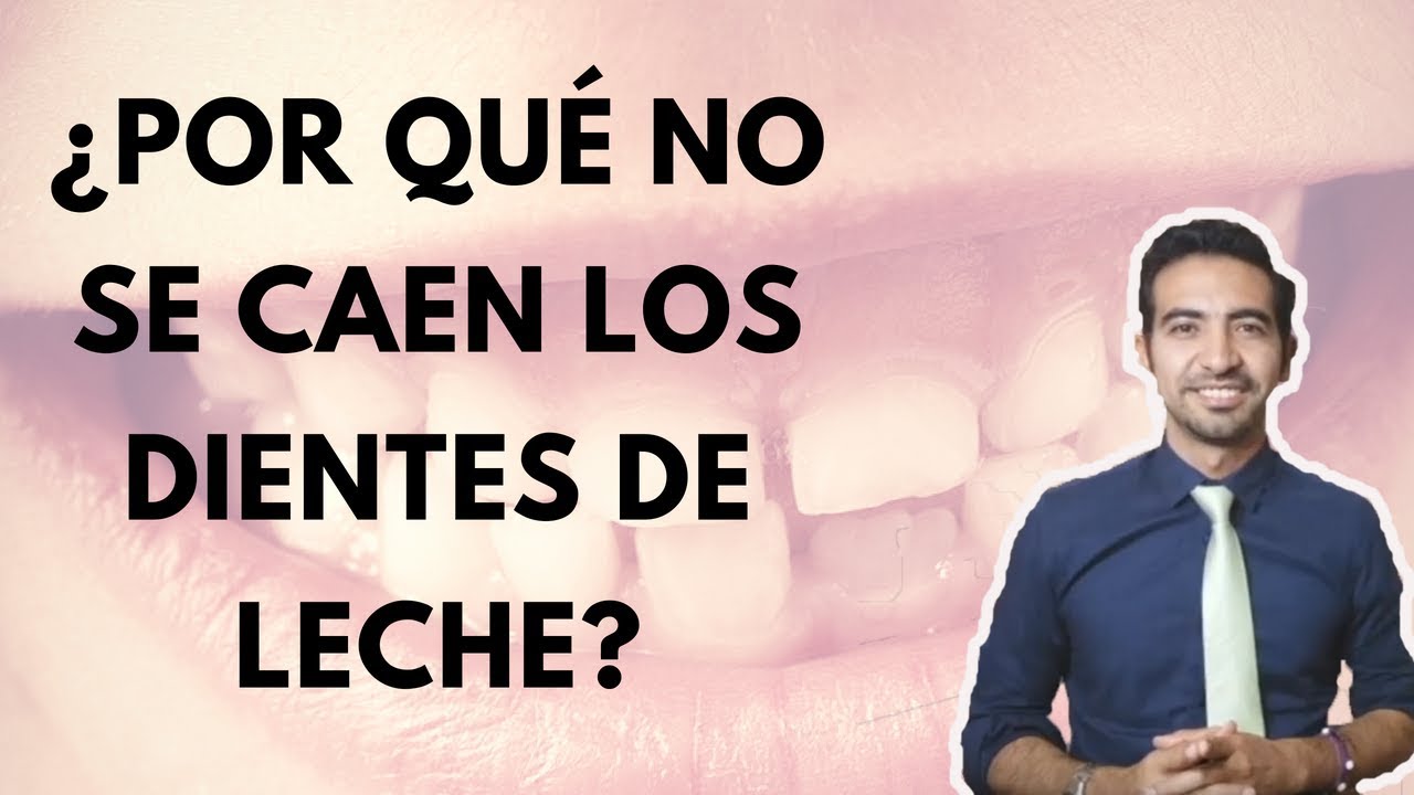 Dientes de leche: ¿Por qué no se caen