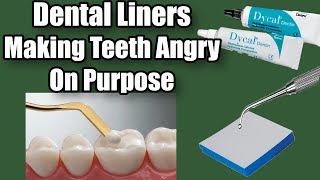 Download lagu Dental Liners - Calcium Hydroxide/Lime-Lite - Dental Assisting 101 mp3 Download lagu Dental Liners - Calcium Hydroxide/Lime-Lite - Dental Assisting 101 mp3