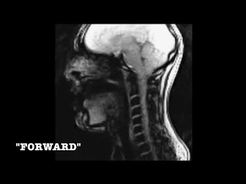 Singing in the MRI with Tyley Ross  - Clip