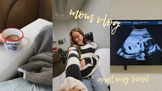 MOM VLOG: anatomy scan + high risk appt, we're sick AGAIN..., CUPSHE vacation haul!!!!