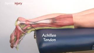 Achilles Tendonitis / Tendinopathy - Explained in 90 Seconds