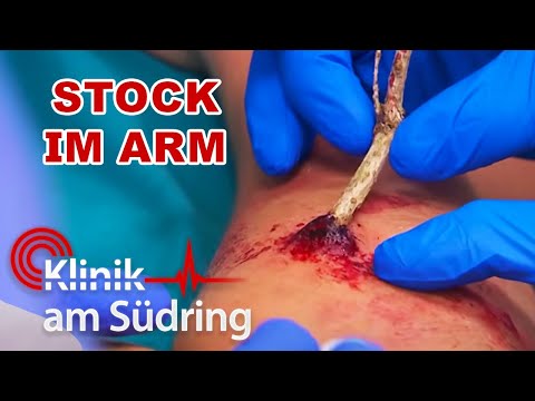 Sturz beim Joggen: Doch was steckt wirklich dahinter? | Klinik am Südring | SAT.1