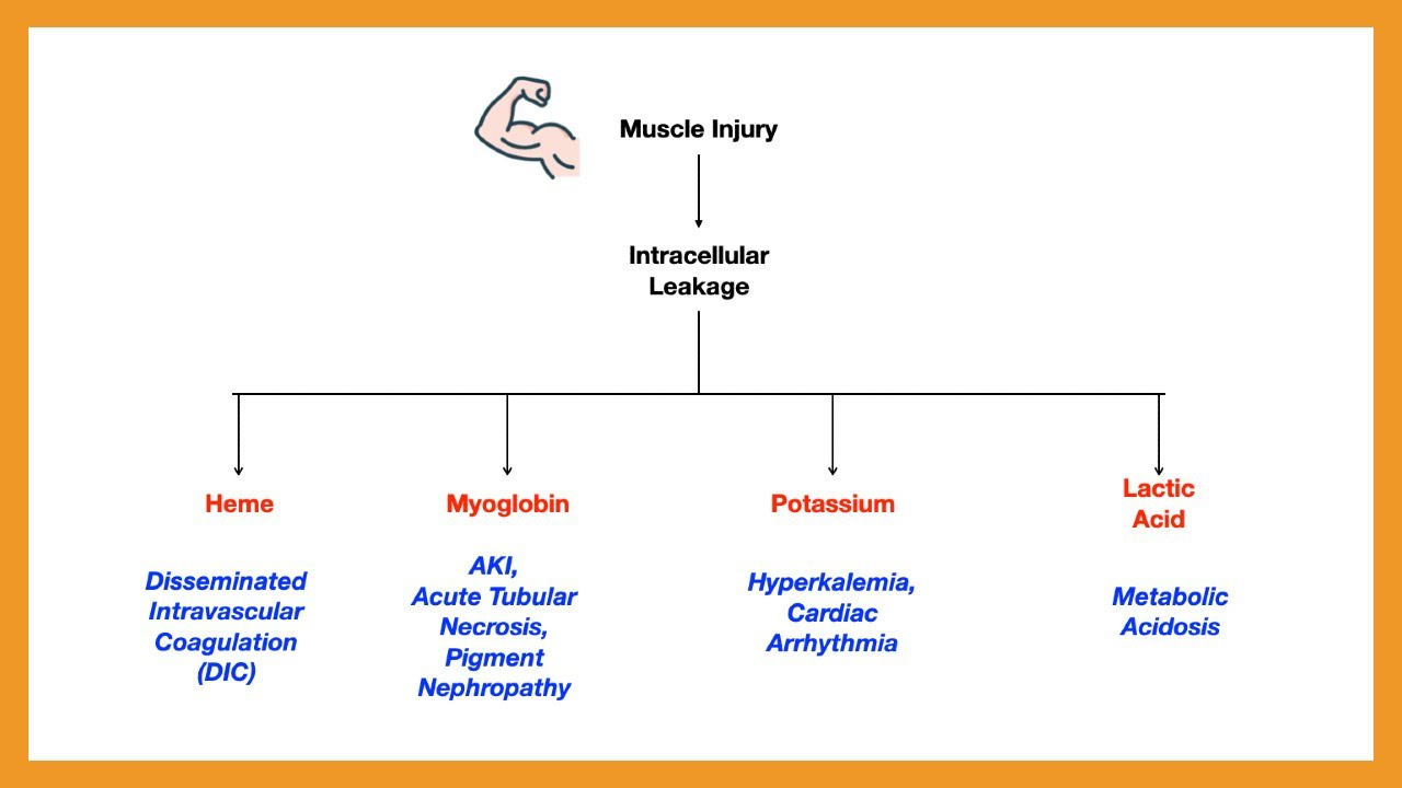 Rhabdomyolysis