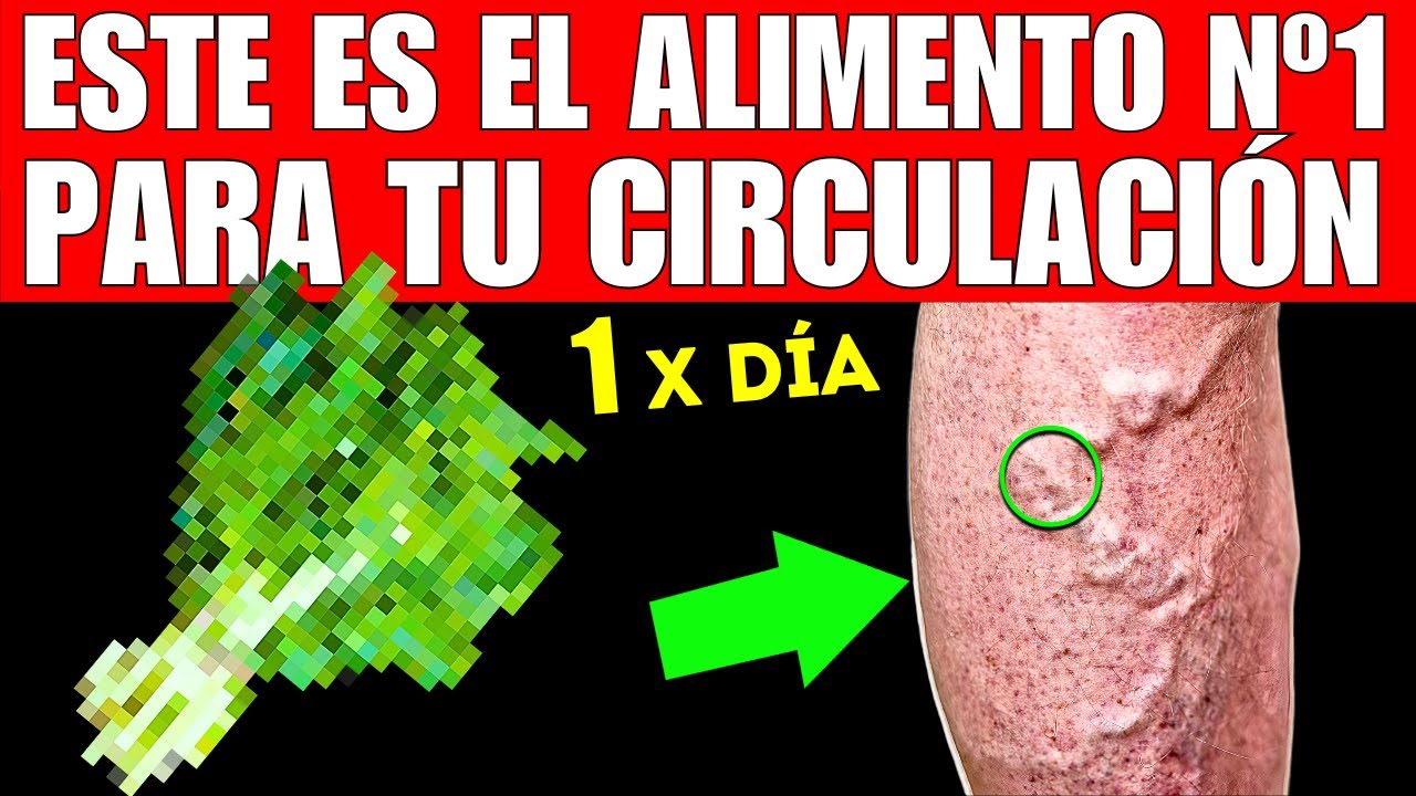 ALIMENTO #1 que MEJORA la INSUFICIENCIA VENOSA (¡No Más VARICES!)