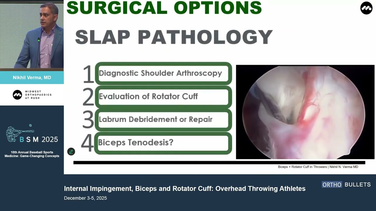 Internal Impingement_Biceps & Rotator Cuff In Overhead Throwing Athletes_Nikil Verma MD