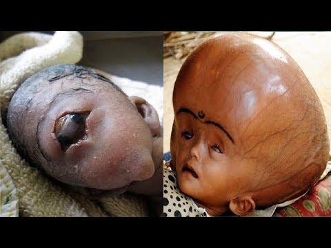 10 Unusual Kids You Wont Believe Were Ever Born Video