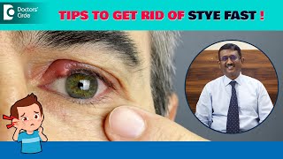 Bump on Eyelid | Stye Eye Treatment | Stye Prevention Tips  – Dr. Sriram Ramalingam| Doctors