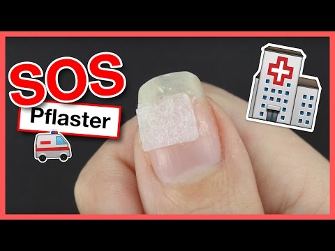 Von gribka eksoderil Wie gribok auf den Beinen die Finger zu heilen