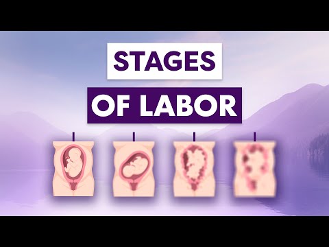 Understanding the Stages of Labor