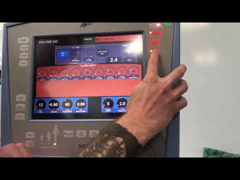 Avea Ventilator Basic Setup/Navigation