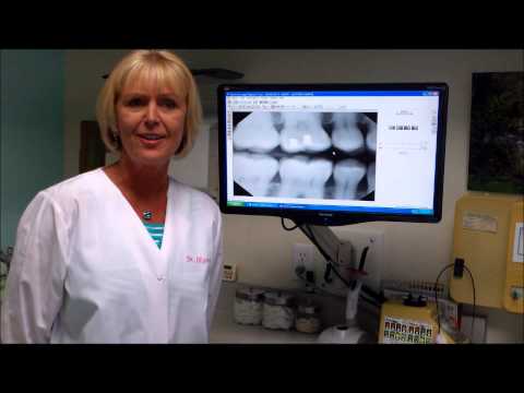 Digital Dental X-Rays Described and Explained